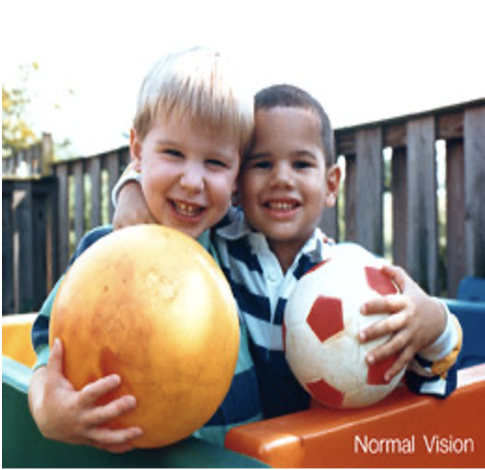 normal vision